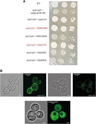 Copper Metabolism in Naegleria gruberi and Its Deadly Relative Naegleria fowleri